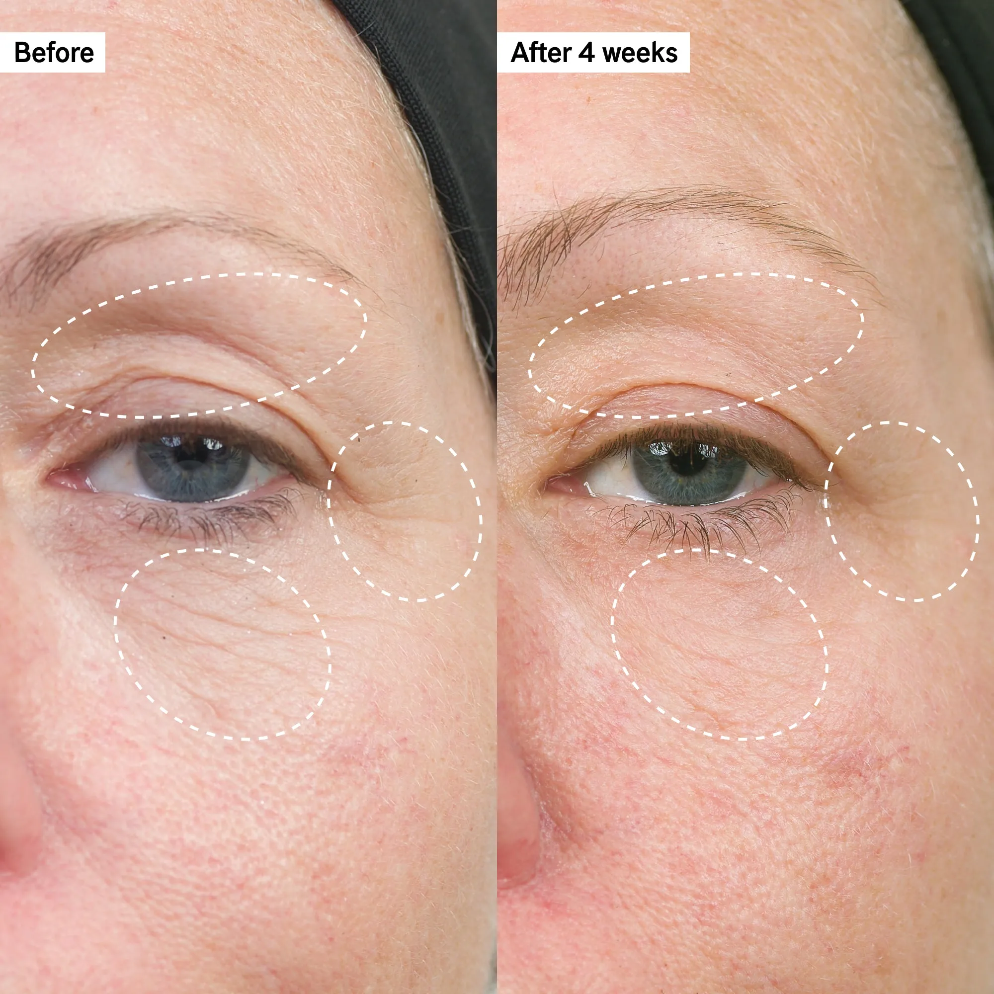 Intro Routine for Anti-Ageing
