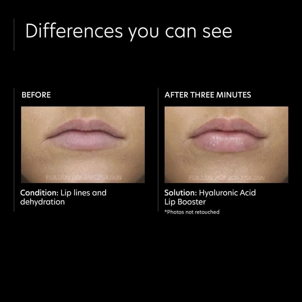 PCA Skin Hyaluronic Acid Lip Booster